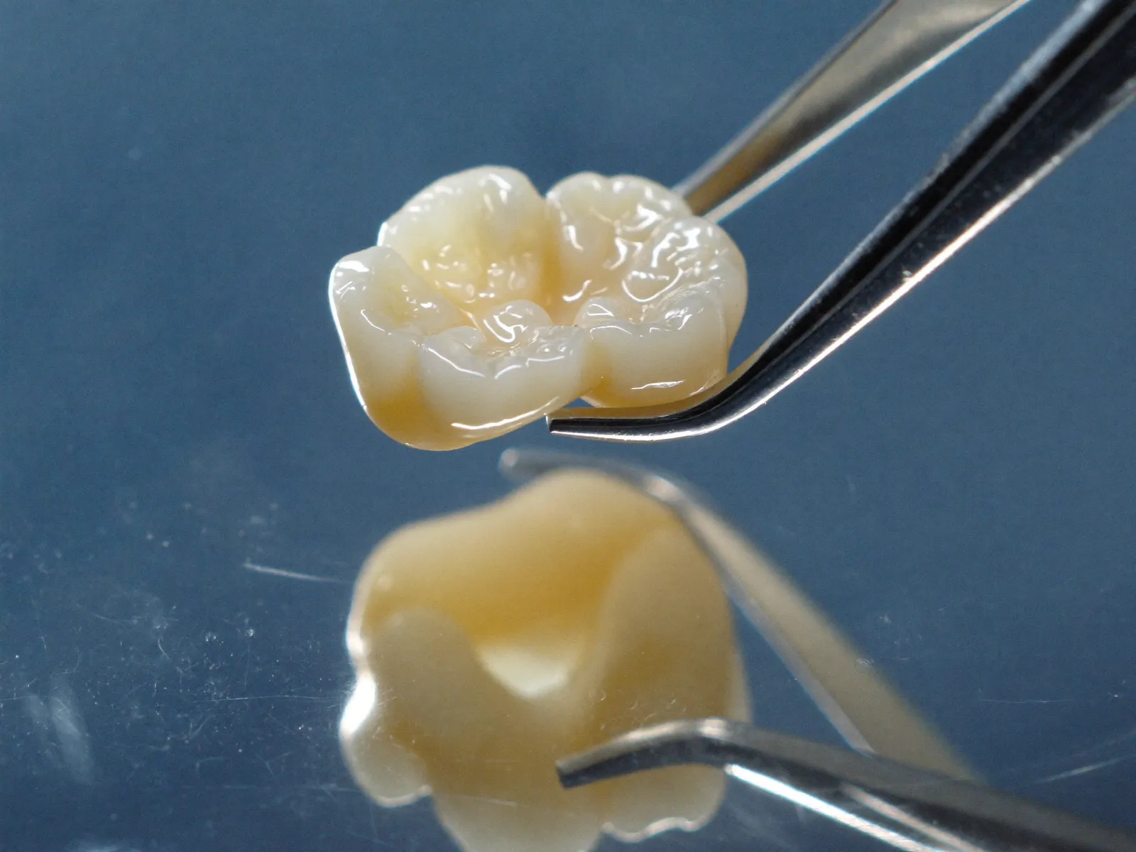 A ceramic dental crown held with tweezers