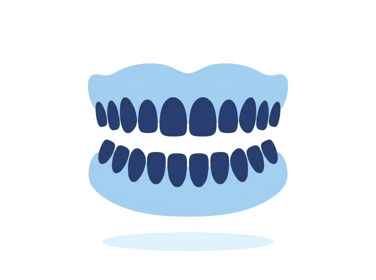 Illustration of a full set of dentures