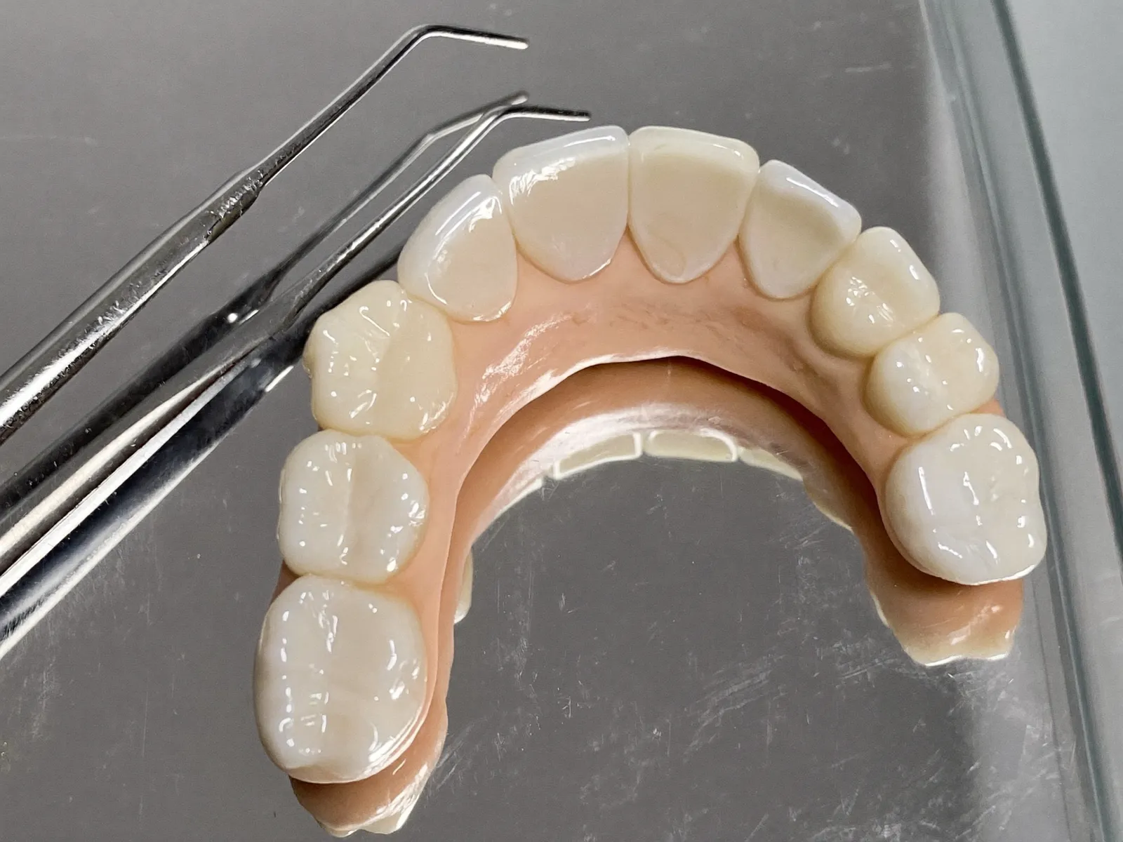 Custom ceramic dental restorations crafted on a dental model
