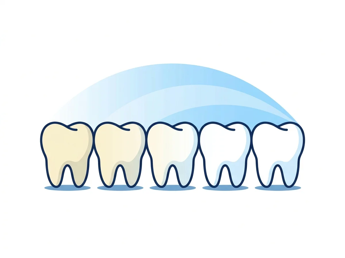 Illustration of teeth brightening in shade